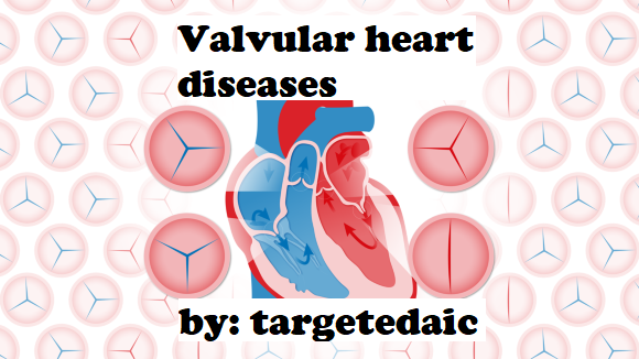 Valvular-Heart-Disease-Hero-new-size-ff0090e6dfe151f191ef114053df10ee Valvular heart diseases and anaesthetic implications.