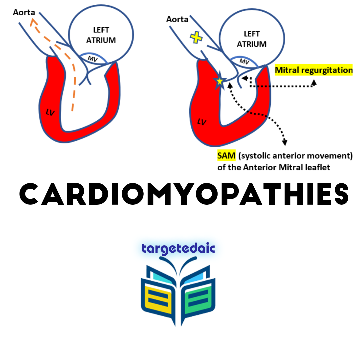 2021-06-10T12_21_04.572675cute_photo cardiomyopathies by targetedaic