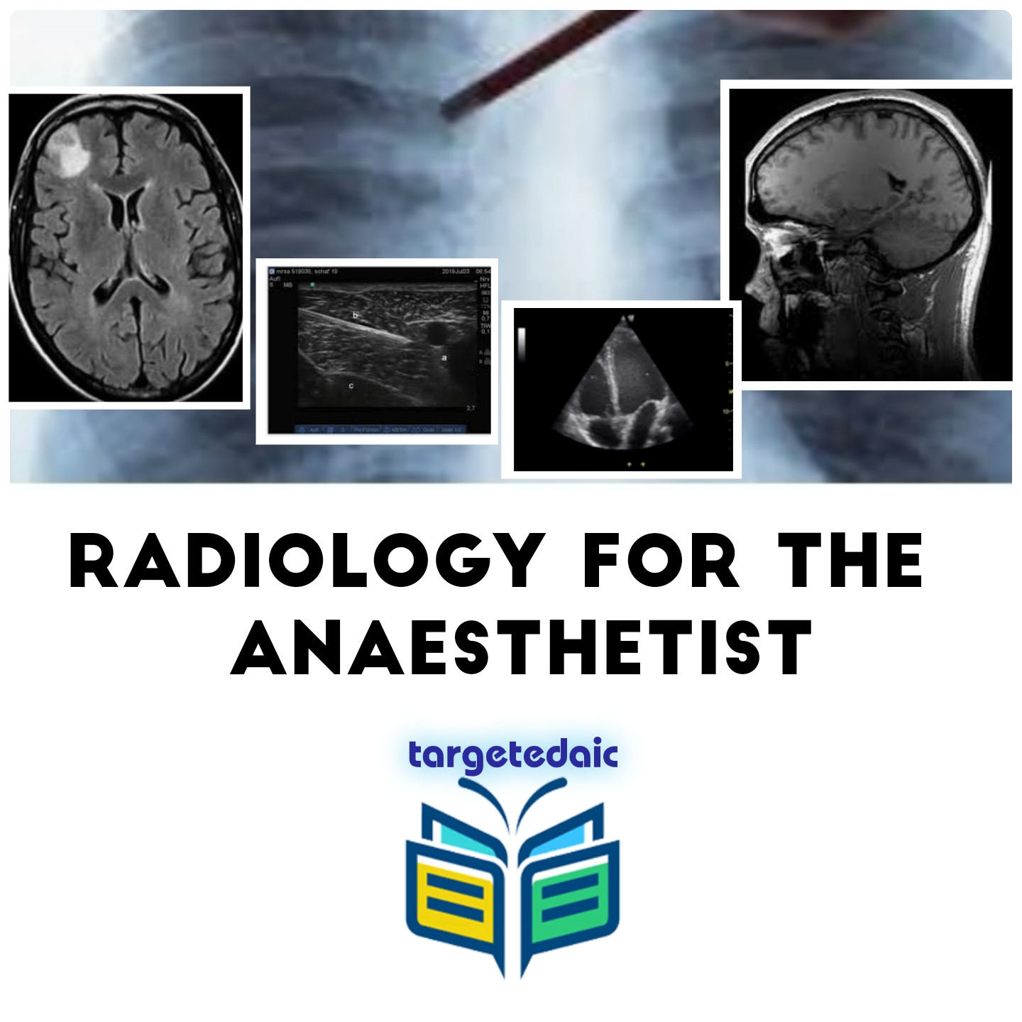 Radiology for the Anaesthetist Radiology for the Anaesthetist